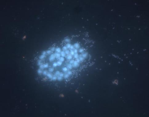 <p>Imagen de microscopio de epifluorescencia conteniendo diferentes morfologías microscópicas no identificadas presentes en las saladas de Monegros. Crédito: A Pena-Baixeras. / CSIC</p>