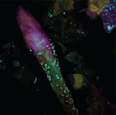 <p>En la imagen se pueden observar alguno de los tipos de hongos analizados. / Alex Valm, NHGRI</p>