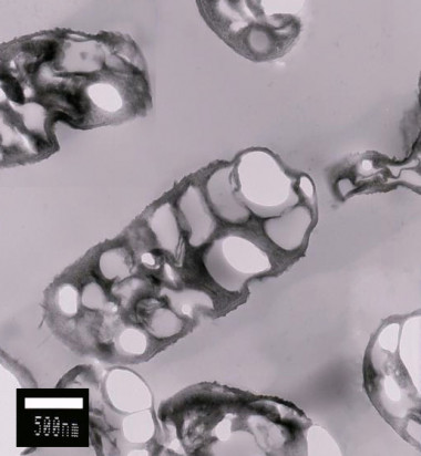 <p>Inclusiones de PHB en células de <em>Bacillus megaterium </em>Uyuni S29. / A. Rodríguez-Contreras/UPC.</p>