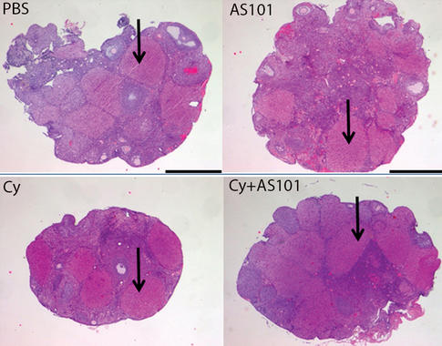 <p>AS101 protege la reserva de huevos en los ovarios de las ratonas tratadas con ciclofosfamida (Cy). / Science Translational Medicine / AAAS</p>