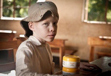 <p>Un niño con albinismo con la crema Kilimanjaro Suncare. / Daniel Losada</p>