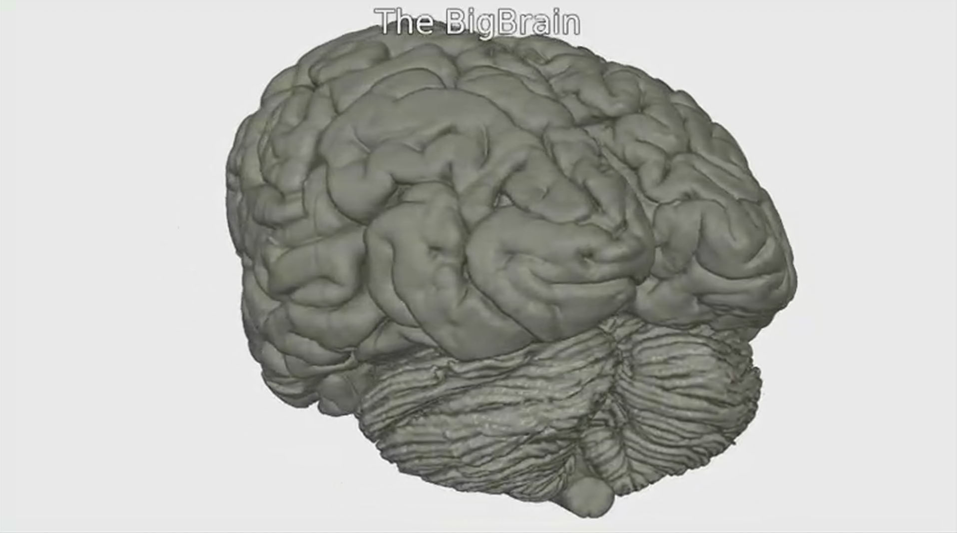 Bigbrain Recrea El Cerebro Humano En 3d Con Una Precisión - 