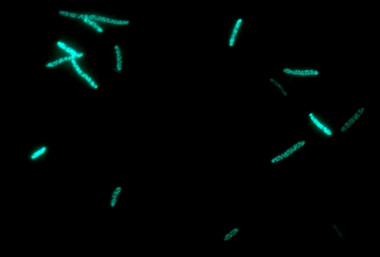 <p>Factories of <em>E. coli</em> bacteria, producing P450, bound to green fluorescent protein. / DTU</p>