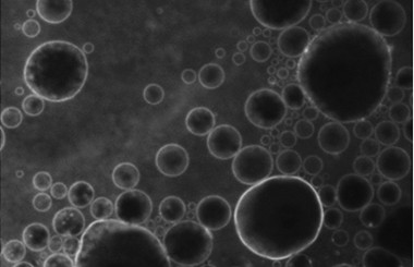 <p>Microbubbles with the fluorescent substance in their lipid coating, from which the effect of the ultrasound causes them to be released into the desired area of the brain. / UEIL, C. Sierra et al.</p>
