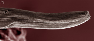 <p><em>Myolaimus ibericus </em>seen by scanning electron microscope. / Joaquín Abolafia</p>
