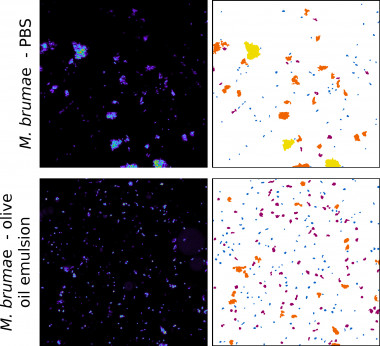 <p>Imágenes de microscopía confocal de la micobacteria <em>M. brumae</em> en una solución convencional (superior) y en una solución basada en emulsión de aceite de oliva (inferior). Se observa como la emulsión de aceite de oliva reduce considerablemente la formación de grumos. / UAB</p>
