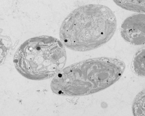 <p>Imagen de microscopía electrónica de transmisión de células de Chlamydomonas sp. ChlSP mostrando acumulaciones de uranio en su interior como gránulos densos a los electrones (puntos negros). / IRNASA.</p>