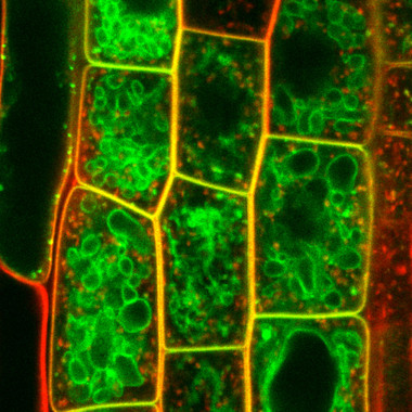 <p>Células de<em> Arabidopsis Thaliana</em> con los canales de fosfato marcados con fluorescencia. / Vicente Rubio (CNB)</p>