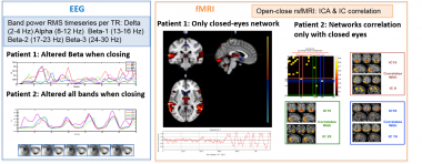 <p>Resultados de EEG y RMf para los dos pacientes. / UPM</p>