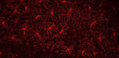 <p>Imagen de microscopía confocal de la activación de células microgliales (marcador de inflamación) en el hippocampo de ratones. / UPF</p>