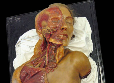 <p>Modelo de cabeza, cuello y parte superior del tórax de una mujer adulta analizada en el estudio. /J. F. Pastor</p>