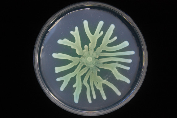 <p>Cultivo de un mutante de Pseudomonas aeruginosa resistente a antibióticos. / Manuel Alcalde, CNB-CSIC</p>