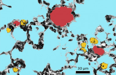 <p>Visualización de nanopartículas de oro (en amarillo) en el pulmón de ratones que las han inhalado. La coloración computacional muestra también los capilares (en rojo) y los espacios alveolares (azul). / Mark Miller et al.</p>
