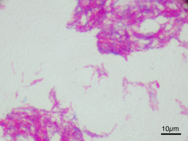 <p class=" text-left">Bacilo de Calmette-Guérin al microscopio. /<a href="https://en.wikipedia.org/wiki/BCG_vaccine#/media/File:Mycobacterium_bovis_BCG_ZN.jpg" target="_self"> Wikipedia</a></p>