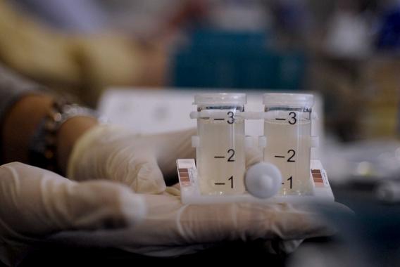 <p>La prueba detecta la bacteria en cuestión de minutos. Imagen: Biótica</p>