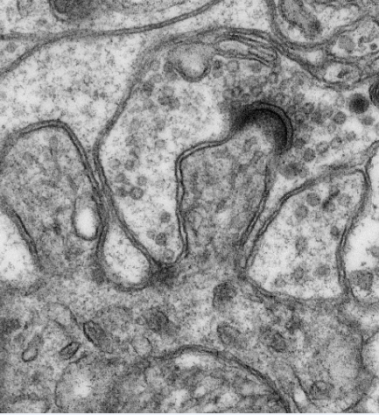 <p>Imagen al microscopio electrónico de transmisión de sinapsis asimétricas en dos áreas del cerebro del pez cebra: el cerebelo y el telencéfalo. / UAB | IIB-Sant Pau</p>