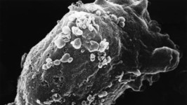 Vista al microscopio electrónico de un linfocito con VIH