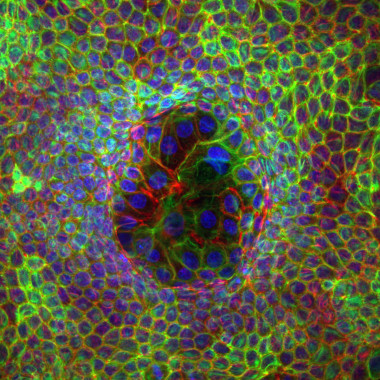 <p>Células superdeformadas rodeadas por otras mínimamente deformadas. El núcleo celular se muestra en azul, los filamentos de actina en rojo y los filamentos de queratina en verde. / IBEC</p>