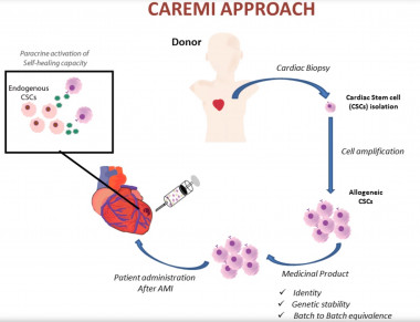 <p>Esquema del estudio CAREMI. Células madre cardiacas procedentes de donantes son cultivadas en el laboratorio para que, a partir de una pequeña biopsia del donante, se puedan producir millones de células que pueda servir para tratar a decenas de pacientes. / CIVERCV</p>