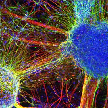<p>Las neuronas generadas con células iPSC de personas con esquizofrenia establecen menos conexiones con otras neuronas. <a href="http://www.agenciasinc.es/esl/imagenes/inicio/(imagen)/78502" target="_self">Foto</a>: Kristen Brennand, Salk Institute for Biological Studies.</p>