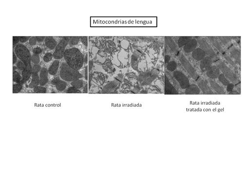 <p>En la lengua de la rata control observamos las mitocondrias con su forma alargada típica y con las crestas en su interior. En la rata irradiada, las mitocondrias están rotas, sin crestas y presentan grandes vacuolas, mientras que en las ratas irradiadas y tratadas con el gel de melatonina no se observa ningún tipo de daño mitocondrial. Las mitocondrias son totalmente normales. / UGR.</p>