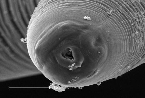 <p>Micrografía electrónica de barrido de <em>Anisakis</em> / <a href="http:/en.wikipedia.org/wiki/File:So4b-08.jpg" target="_blank">Wikipedia</a>.</p>