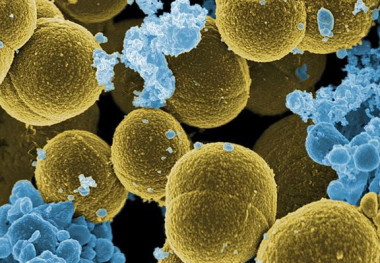<p><em>S. aureus</em> bacteria escapando de la destrucción por células blancas humanas. / <a href="https://commons.wikimedia.org/wiki/File:Staphylococcus_aureus_bacteria_escape.jpg" target="_blank">Wikipedia</a></p>