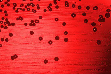
<!-- START: including template: extension/sinc/design/ezwebin/templates/content/datatype/view/ezxmltags/paragraph.tpl (design:content/datatype/view/ezxmltags/paragraph.tpl) -->
<p>En la imagen, la bacteria 
<!-- START: including template: extension/sinc/design/sinc/templates/content/datatype/view/ezxmltags/emphasize.tpl (design:content/datatype/view/ezxmltags/emphasize.tpl) -->
<em>Haemophilus influenzae</em>
<!-- STOP: including template: extension/sinc/design/sinc/templates/content/datatype/view/ezxmltags/emphasize.tpl (design:content/datatype/view/ezxmltags/emphasize.tpl) -->
, causante de miles de muertes en todo el mundo. Foto: Public Health Image Library.</p>
<!-- STOP: including template: extension/sinc/design/ezwebin/templates/content/datatype/view/ezxmltags/paragraph.tpl (design:content/datatype/view/ezxmltags/paragraph.tpl) -->
