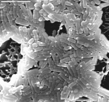 <p>Cultivo de bifidobacterias fotografiadas al microscopio de criocongelación y barrido. / Patricia Ruas Madiedo.</p>