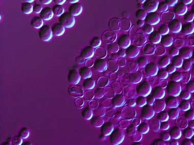 <p>Imágenes microscópicas de células de levadura del vino <em>Saccharomyces cerevisiae</em> afectadas por la deshidratación. Imagen: UV.</p>