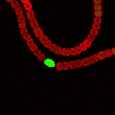 <p>Vista de lacianobacteria
