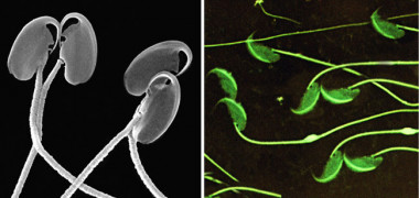 <p>Espermatozoides de ratón de campo vistos con microscopia electrónica de barrido (izq) y espermatozoides de ratón moruno (derecha). / Eduardo Roldán</p>