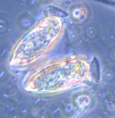 <p><a href="http://plataformasinc.es/index.php/esl/imagenes/inicio/(imagen)/37655" target="_self">Pareja de Dinophysis</a>, microalga productora de ácido okadaico. Foto: IRTA.</p>