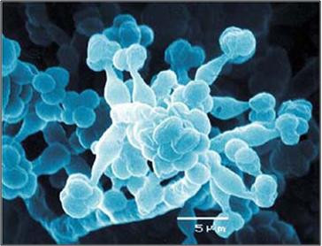 <p>Imagen al microscopio del hongo