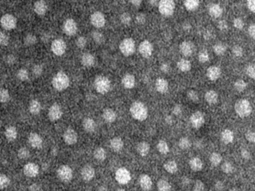 <p>Imagen al microscopio de los exosomas. Foto: UCM. </p>