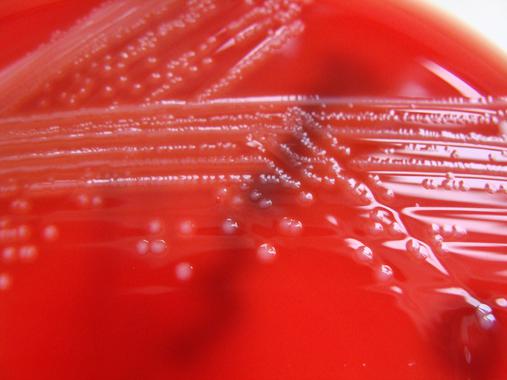 <p>Cultivo de <em>Listeria monocytogenes. / </em><a href="http://es.wikipedia.org/wiki/Listeria_monocytogenes#mediaviewer/File:Listeria_monocytogenes_-_Columbia_Horse_Blood_Agar_-Detail.jpg" target="_blank">Wikipedia</a></p>