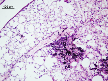 <p>El hongo<em> Aspergillus</em> en pulmón de ratón. / Foto cedida a DiCYT por José Antonio Calera.</p>
