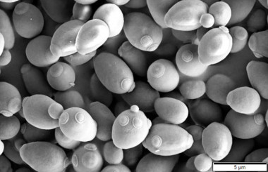 <p>Levadura de la cerveza <em>(Saccharomyces cerevisiae). / </em>Wikipedia</p>