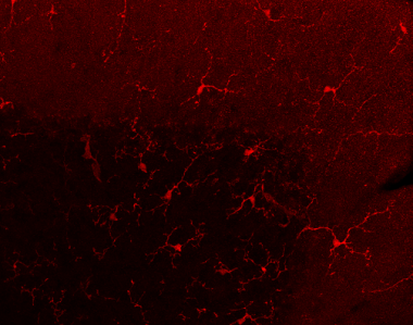<p>Imagen de microscopía que muestra células de la microglía en la corteza del cerebelo de ratón. / UPF</p>