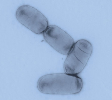 <p>La salmonella enterica es uno de los principales patógenos entéricos tanto en países desarrollados como en regiones en vías de desarrollo. / UB</p>