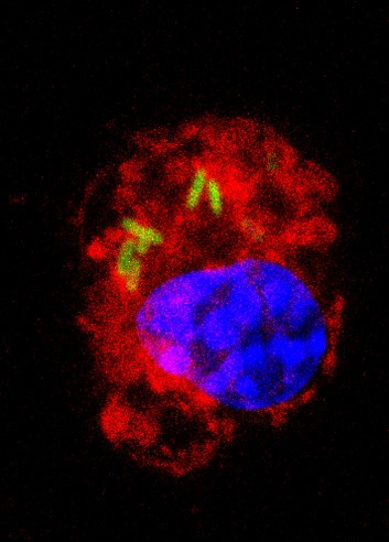 <p>Los macrófagos también se convierten en el nicho biológico que algunas cepas bacterianas prefieren para replicarse y diseminarse por todo el cuerpo. / UB</p>