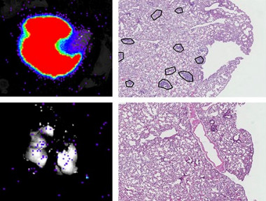 <p>A la izquierda detección de metástasis de células de cáncer de mama que emiten luz en el pulmón de ratones. A la derecha células tumorales no modificadas (arriba) y células tumorales sin USP27X (debajo), las metástasis están marcadas con círculos. / UPF</p>