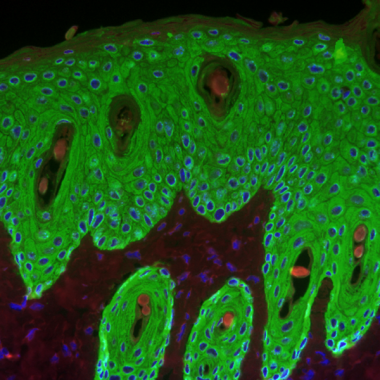 <p>Queratinocitos (en verde) de la piel de un ratón. / <a href="http://en.wikipedia.org/wiki/File:Proliferative_response_induced_by_a_tumor_promoter_in_the_epidermis_of_a_wild-type_mouse_-_image.pbio.v11.i07.g001.png" target="_blank">Wikipedia</a></p>