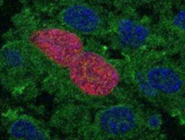 <p>Imagen representativa de la proliferación inducida por la presencia de AID en células epiteliales de páncreas. / CNIC</p>