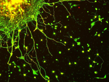 <p>Cultivo de neuronas. / <a href="https://www.flickr.com/photos/thelunch_box/2798522576/in/photolist-5giagf-j3n9hE-75SmyS-epqjXb-5J4uci-4v1pXb-4JcJ4G-efmaRg-m93ET4-8eisF6-gKzo2g-4m9vic-2WE92-7EAC3X-qJfuhJ-8dvG3G-tPh5-q8n7e-nxMXcN-8emKtG-boovFk-7gXAf1-7gVQDj-7gRf7M-9JCBMe-bxvKyF-jxNK4h-a3vLiF-8YVKFz-bx1iPV-5JiBVU-7ST91p-brous1-efrVcy-8jwa63-9ff4DS-7ST91r-rgqQq4-9VWTjy-75hHEz-7PKSWh-55wUVz-a4UhJa-bkKTch-53JJbM" target="_blank">MR McGill</a></p>