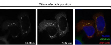 <p>Tras la infeccion, numerosas proteinas celulares (por ejemplo, Gemin5) se concentran en las factorias de replicacion del ARN viral. / UAM Gazette</p>
