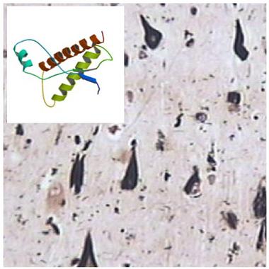 <p>Sección de cortex cerebral con tau hiperfosforilada (en negro). En el recuadro, modelo de proteína PRPc. / J. Antonio del Río.</p>