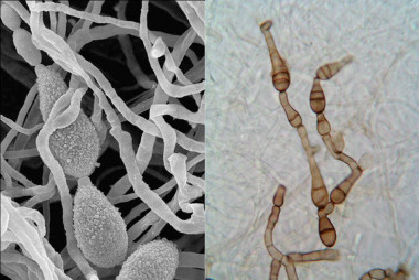 <p>Hongo alternaria alternata visto en un microscopio electrónico (izquierda) y hongo alternaria infectoria visto por un microscopio óptico (derecha). / URV</p>