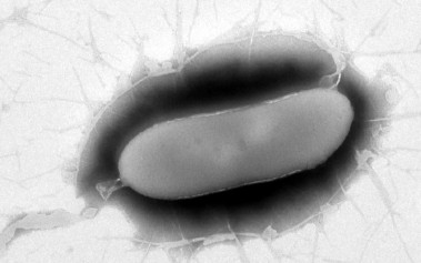 <p>La nueva bacteria<em> Pseudomonas versuta</em> hallada en la Antártida. / Álvaro Peix.</p>