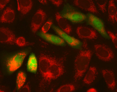 
<!-- START: including template: extension/sinc/design/ezwebin/templates/content/datatype/view/ezxmltags/paragraph.tpl (design:content/datatype/view/ezxmltags/paragraph.tpl) -->
<p>Células de melanoma transfectadas con el gen E. Foto: UGR.</p>
<!-- STOP: including template: extension/sinc/design/ezwebin/templates/content/datatype/view/ezxmltags/paragraph.tpl (design:content/datatype/view/ezxmltags/paragraph.tpl) -->
